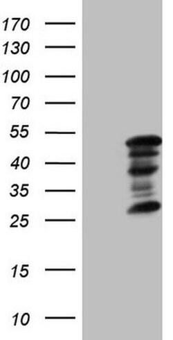 ZC3H8 Monoclonal Antibody (OTI3G10), TrueMAB , OriGene 30 &mu;L; Unconjugated:Antibodies,