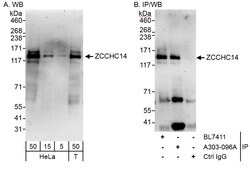 ZCCHC14 Rabbit anti-Human, Polyclonal, Bethyl Laboratories 100 &mu;L; Unconjugated:Antibodies,