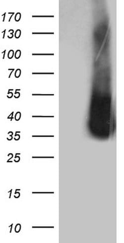 ZCCHC17 Mouse anti-Human, Clone: OTI1F11, lyophilized, TrueMAB 100 &mu;g;