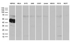 ZCCHC17 Mouse anti-Human, Clone: OTI1F11, lyophilized, TrueMAB 100 &mu;g;