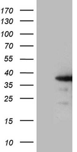 ZCCHC17 Mouse anti-Human, Clone: OTI9A7, lyophilized, TrueMAB 100 &mu;g;