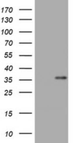 ZCCHC24 Mouse anti-Human, Clone: OTI2E1, lyophilized, TrueMAB 100 &mu;g;