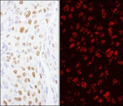 ZCCHC8 Rabbit anti-Human, Polyclonal, Bethyl Laboratories 100 &mu;L; Unconjugated:Antibodies,