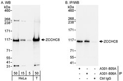 ZCCHC8 Rabbit anti-Human, Polyclonal, Bethyl Laboratories 100 &mu;L; Unconjugated:Antibodies,