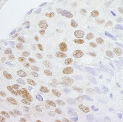 ZCCHC8 Polyclonal Antibody, Bethyl Laboratories:Antibodies:Primary Antibodies
