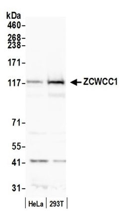 ZCWCC1 Rabbit anti-Human, Polyclonal, Bethyl Laboratories 100 &mu;l; Unlabeled:Antibodies,
