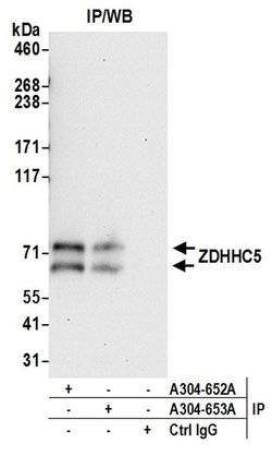ZDHHC5 Rabbit anti-Human, Polyclonal, Bethyl Laboratories 100 &mu;L; Unconjugated:Antibodies,