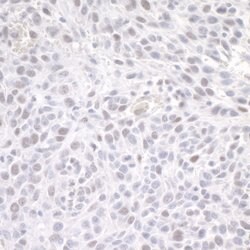 ZEB1 Rabbit anti-Human, Mouse, Polyclonal, Bethyl Laboratories 100 &mu;L;