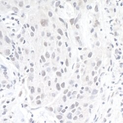 ZEB1 Rabbit anti-Human, Mouse, Polyclonal, Bethyl Laboratories 100 &mu;L;
