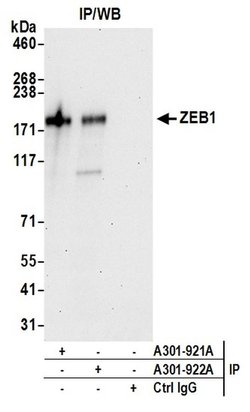 ZEB1 Rabbit anti-Human, Mouse, Polyclonal, Bethyl Laboratories 100 &mu;L;