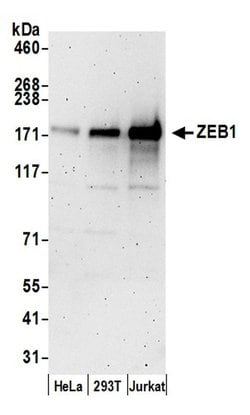 ZEB1 Polyclonal Antibody, Bethyl Laboratories 20 &mu;L; Unconjugated:Antibodies,