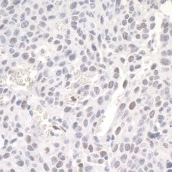 ZEB1 Polyclonal Antibody, Bethyl Laboratories 10 μL; Unconjugated:Antibodies,