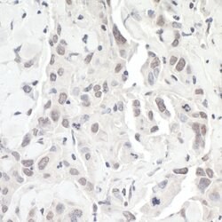 ZEB1 Polyclonal Antibody, Bethyl Laboratories:Antibodies:Primary Antibodies