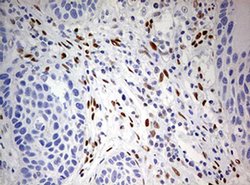 ZEB1 Monoclonal Antibody (OTI7E12), TrueMAB , OriGene 100 &mu;L; Unconjugated:Antibodies,