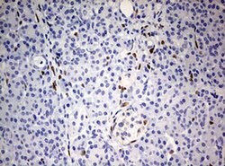 ZEB1 Monoclonal Antibody (OTI7E12), TrueMAB , OriGene 100 &mu;L; Unconjugated:Antibodies,