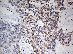 ZEB1 Monoclonal Antibody (OTI7E12), TrueMAB , OriGene 100 &mu;L; Unconjugated:Antibodies,