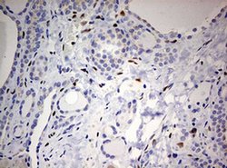 ZEB1 Monoclonal Antibody (OTI7E12), TrueMAB , OriGene 100 &mu;L; Unconjugated:Antibodies,