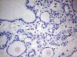 ZEB1 Monoclonal Antibody (OTI7E12), TrueMAB , OriGene 100 &mu;L; Unconjugated:Antibodies,
