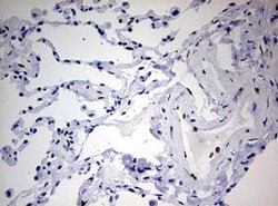 ZEB1 Monoclonal Antibody (OTI7E12), TrueMAB , OriGene:Antibodies:Primary