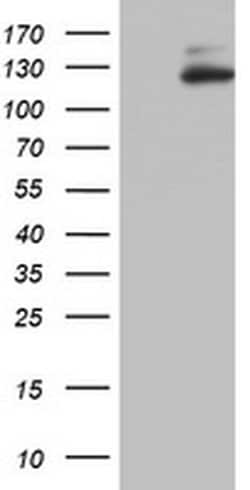 ZEB1 Monoclonal Antibody (OTI5B8), TrueMAB , OriGene 100 &mu;L; Unconjugated:Antibodies,
