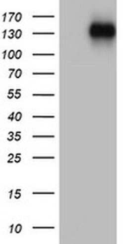 ZEB1 Monoclonal Antibody (OTI7E12), TrueMAB , OriGene:Antibodies:Primary