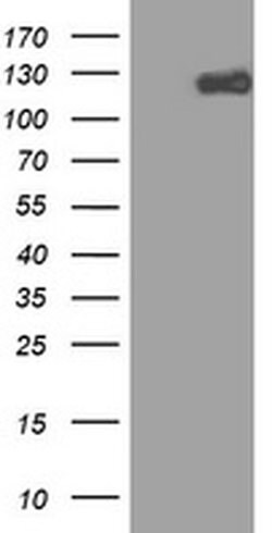 ZEB1 Monoclonal Antibody (OTI10A12), TrueMAB , OriGene 100 &mu;L; Unconjugated:Antibodies,