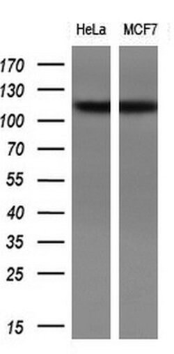 ZEB1 Monoclonal Antibody (OTI10A12), TrueMAB , OriGene 100 &mu;L; Unconjugated:Antibodies,