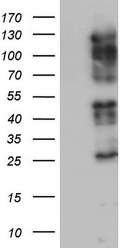 ZEB1 Monoclonal Antibody (OTI8H8), TrueMAB , OriGene 100 &mu;L; Unconjugated:Antibodies,