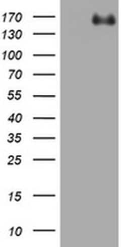 ZEB1 Monoclonal Antibody (OTI4B8), TrueMAB , OriGene 100 &mu;L; Unconjugated:Antibodies,