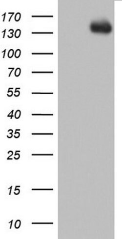 ZEB1 Mouse anti-Human, Clone: OTI9G3, lyophilized, TrueMAB 100 &mu;g; Unconjugated:Antibodies,