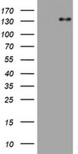 ZEB2 Monoclonal Antibody (OTI4D12), TrueMAB , OriGene 100 &mu;L; Unconjugated:Antibodies,