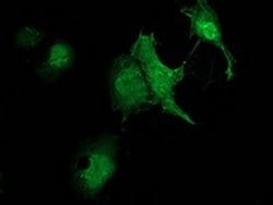ZFAND2B Monoclonal Antibody (OTI3A2), TrueMAB , OriGene:Antibodies:Primary