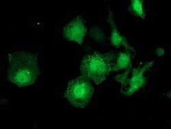 ZFAND2B Monoclonal Antibody (OTI3D6), TrueMAB , OriGene 100 &mu;L; Unconjugated:Antibodies,