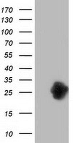 ZFAND2B Monoclonal Antibody (OTI3A2), TrueMAB , OriGene:Antibodies:Primary