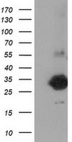 ZFAND2B Monoclonal Antibody (OTI3E3), TrueMAB , OriGene:Antibodies:Primary