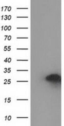 ZFAND2B Mouse anti-Human, Clone: OTI1D5, lyophilized, TrueMAB 100 &mu;g;