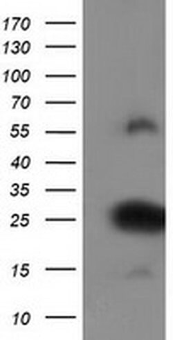 ZFAND2B Monoclonal Antibody (OTI2E11), TrueMAB , OriGene 100 &mu;L; Unconjugated:Antibodies,