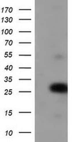 ZFAND2B Monoclonal Antibody (OTI2E4), TrueMAB , OriGene:Antibodies:Primary