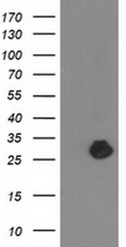 ZFAND2B Monoclonal Antibody (OTI1G10), TrueMAB , OriGene 100 &mu;L; Unconjugated:Antibodies,