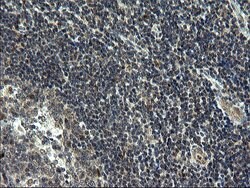 ZFAND3 Monoclonal Antibody (OTI1E9), TrueMAB , OriGene 100 &mu;L; Unconjugated:Antibodies,