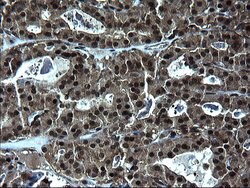 ZFAND3 Monoclonal Antibody (OTI1H9), TrueMAB , OriGene 100 &mu;L; Unconjugated:Antibodies,