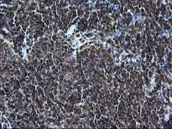 ZFAND3 Monoclonal Antibody (OTI1H9), TrueMAB , OriGene 100 &mu;L; Unconjugated:Antibodies,