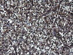 ZFAND3 Monoclonal Antibody (OTI1H9), TrueMAB , OriGene 100 &mu;L; Unconjugated:Antibodies,