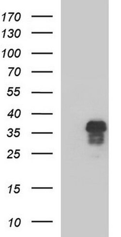 ZFAND3 Monoclonal Antibody (OTI1H9), TrueMAB , OriGene 100 &mu;L; Unconjugated:Antibodies,