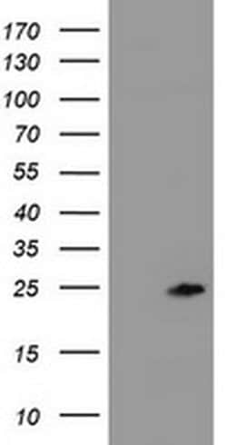 ZFAND5 Monoclonal Antibody (OTI1D8), TrueMAB , OriGene 100 &mu;L; Unconjugated:Antibodies,