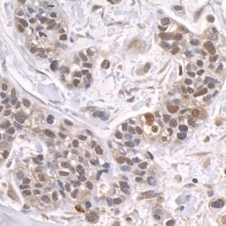 ZFP106 Rabbit anti-Human, Polyclonal, Bethyl Laboratories 100 &mu;L; Unconjugated:Antibodies,