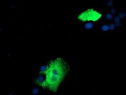 ZFP36 Monoclonal Antibody (OTI1F2), TrueMAB , OriGene 100 &mu;L; Unconjugated:Antibodies,