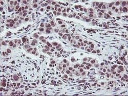 ZFP36 Mouse anti-Human, Clone: OTI1A2, liquid, TrueMAB 100 &mu;L; Unconjugated:Antibodies,