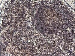 ZFP36 Mouse anti-Human, Clone: OTI1A2, liquid, TrueMAB 100 &mu;L; Unconjugated:Antibodies,