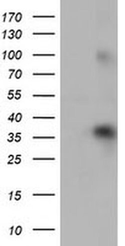 ZFP36 Monoclonal Antibody (OTI4B10), TrueMAB , OriGene 100 &mu;L; Unconjugated:Antibodies,